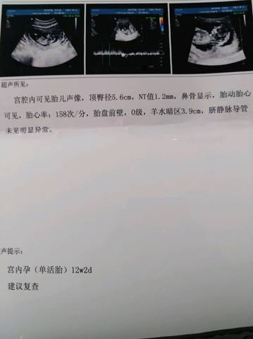 journal_insert_pic_800209689