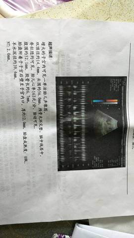 journal_insert_pic_800091416
