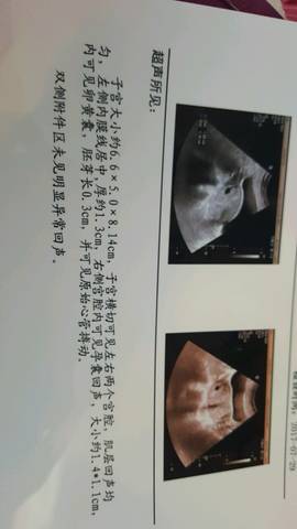 journal_insert_pic_802386544