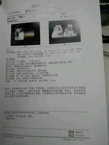 journal_insert_pic_803209667