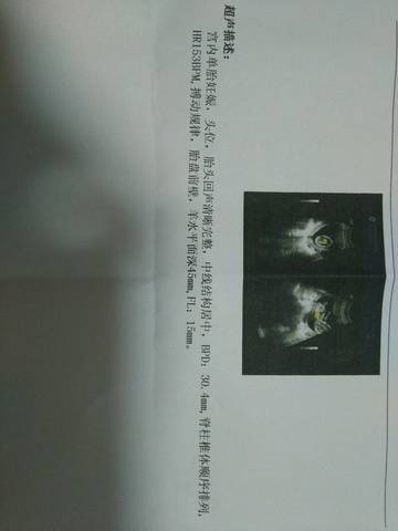 journal_insert_pic_802879589