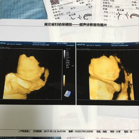 journal_insert_pic_807128902