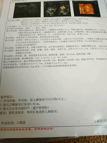 journal_insert_pic_808200141