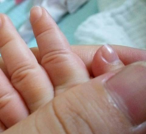 新生儿指甲正常图片图片