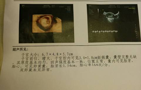 journal_insert_pic_807960693