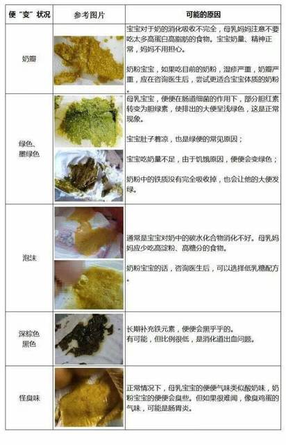 大人正常大便标准图片,哪种不正常图片,带图片(第9页)_大山谷图库