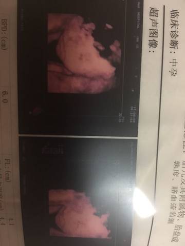 journal_insert_pic_811117815