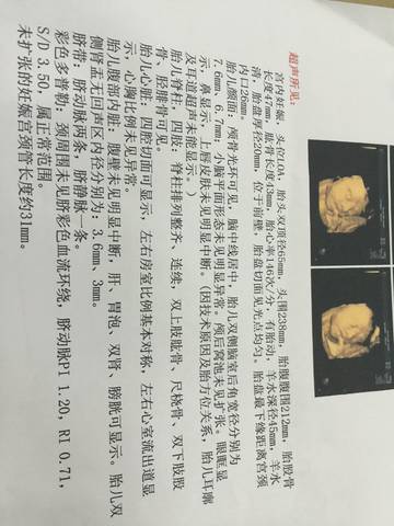 journal_insert_pic_812316804