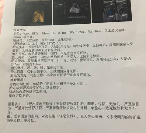 journal_insert_pic_813785681