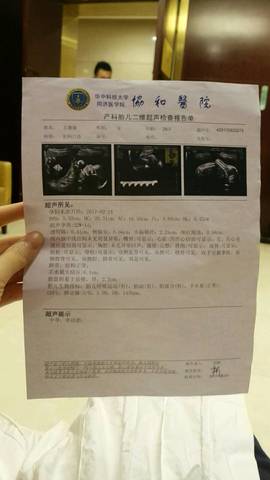 journal_insert_pic_813241551