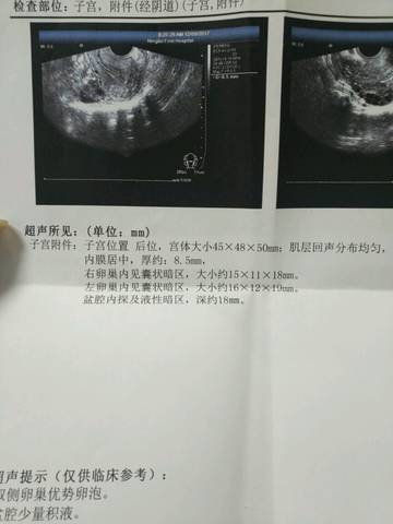 journal_insert_pic_813285539