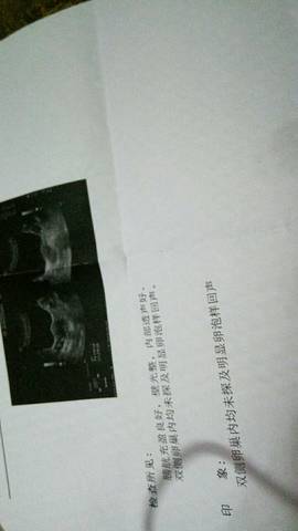 journal_insert_pic_815961130