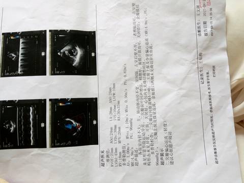 journal_insert_pic_816393130