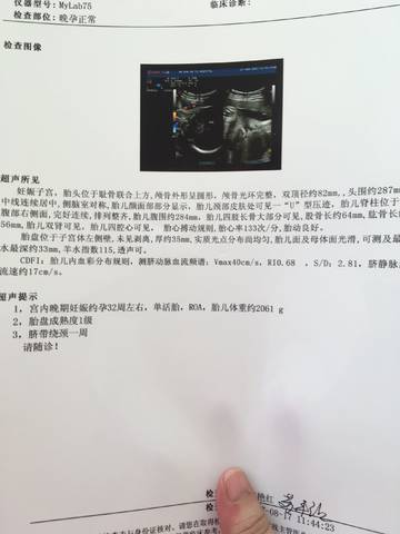 journal_insert_pic_817165311