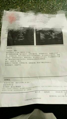 journal_insert_pic_817304085