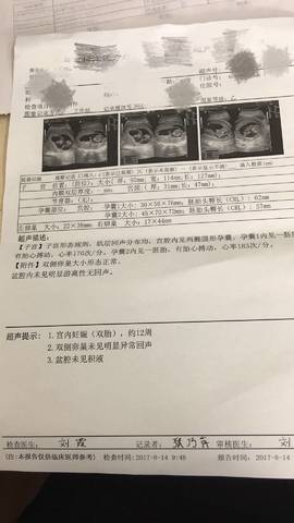 journal_insert_pic_817687270