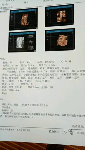 journal_insert_pic_817864884