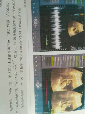 journal_insert_pic_819201056