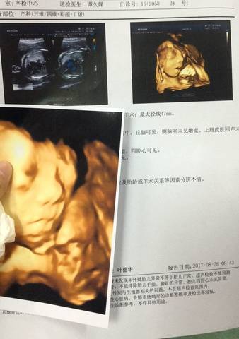 journal_insert_pic_824291042