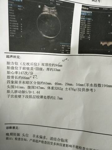 journal_insert_pic_825151736