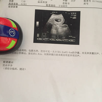 journal_insert_pic_827182354