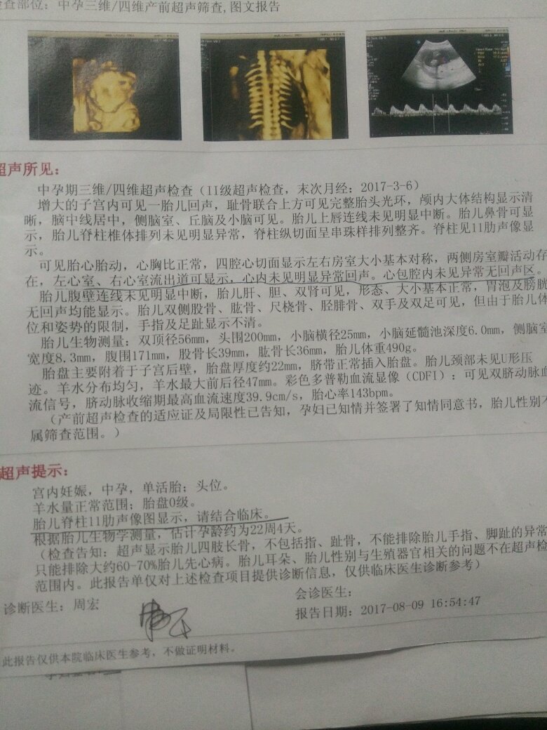 我做四维彩超检查出宝宝少一根骨头，