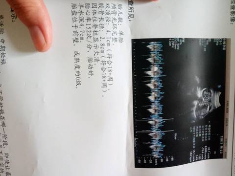 journal_insert_pic_831692805