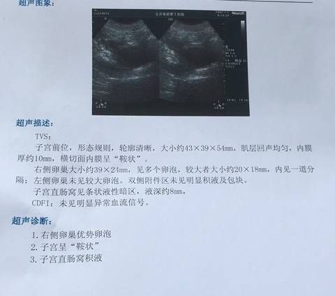 journal_insert_pic_832624614