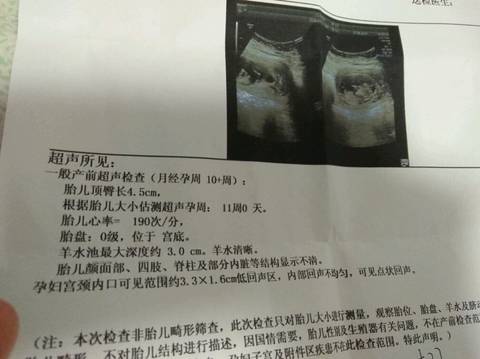 journal_insert_pic_833321272