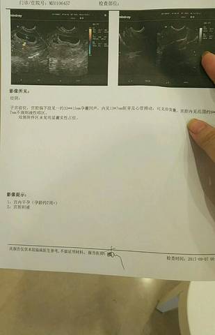 journal_insert_pic_833600500