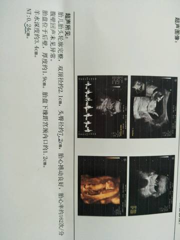 journal_insert_pic_837184930