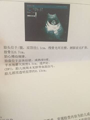 journal_insert_pic_837190148