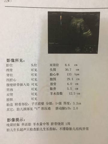 journal_insert_pic_838648195