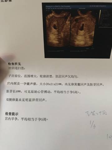 journal_insert_pic_838980208