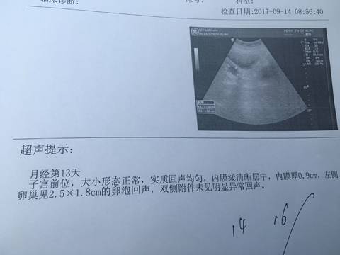 journal_insert_pic_838577745