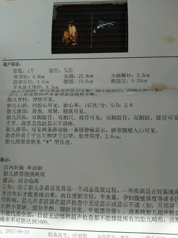 journal_insert_pic_839304046