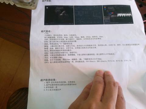 journal_insert_pic_839255618