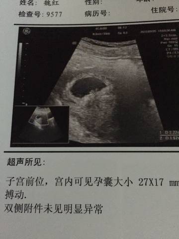 journal_insert_pic_839531398