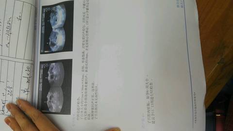 journal_insert_pic_841778280