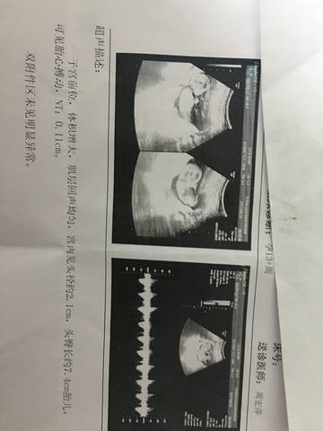 journal_insert_pic_841595125