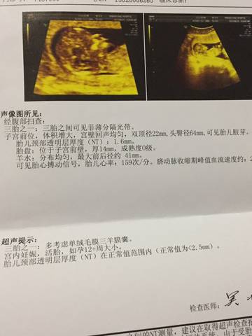 journal_insert_pic_842203882