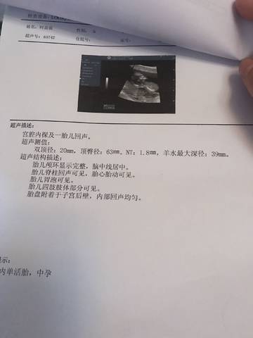 journal_insert_pic_844011858