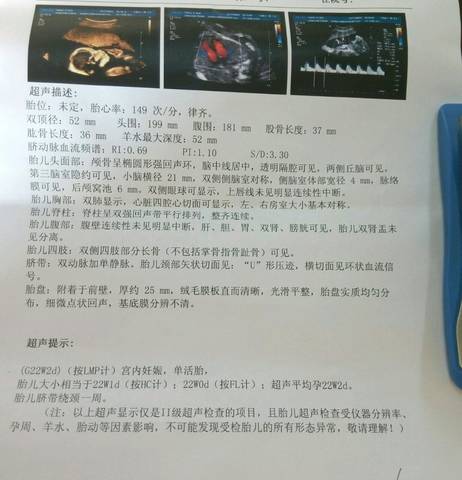 journal_insert_pic_845296062