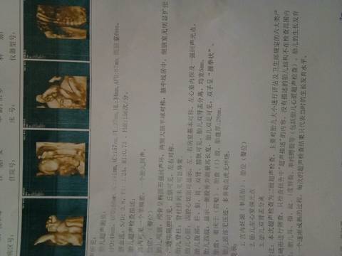 journal_insert_pic_846248430