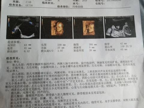 journal_insert_pic_847898882
