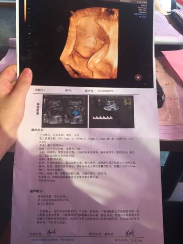 journal_insert_pic_848279141