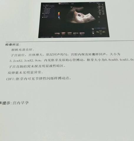 journal_insert_pic_848138549