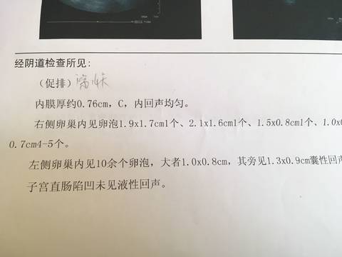 journal_insert_pic_848935004