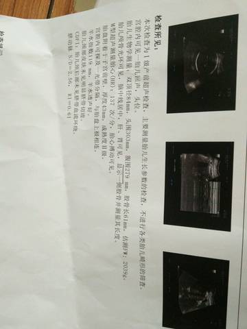 journal_insert_pic_848877690