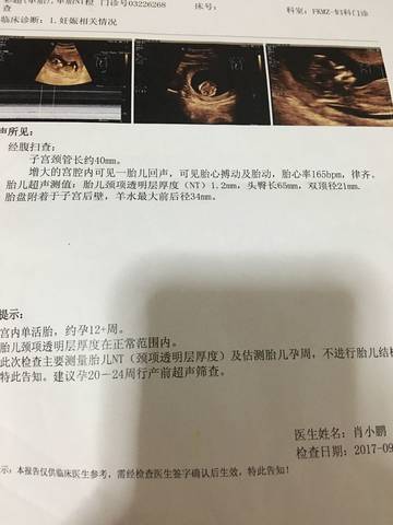 journal_insert_pic_849189048